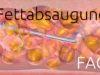 Fettabsaugen – Liposuktion – FAQ