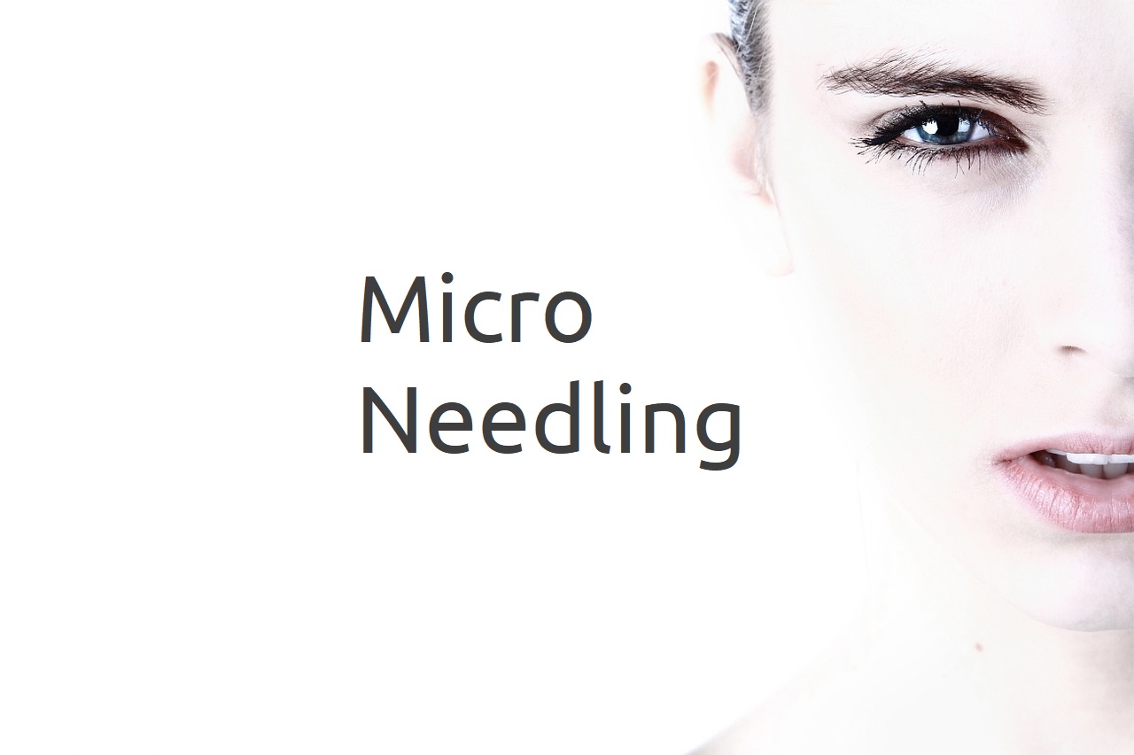 Was sind die Vorteile von Micro-Needling