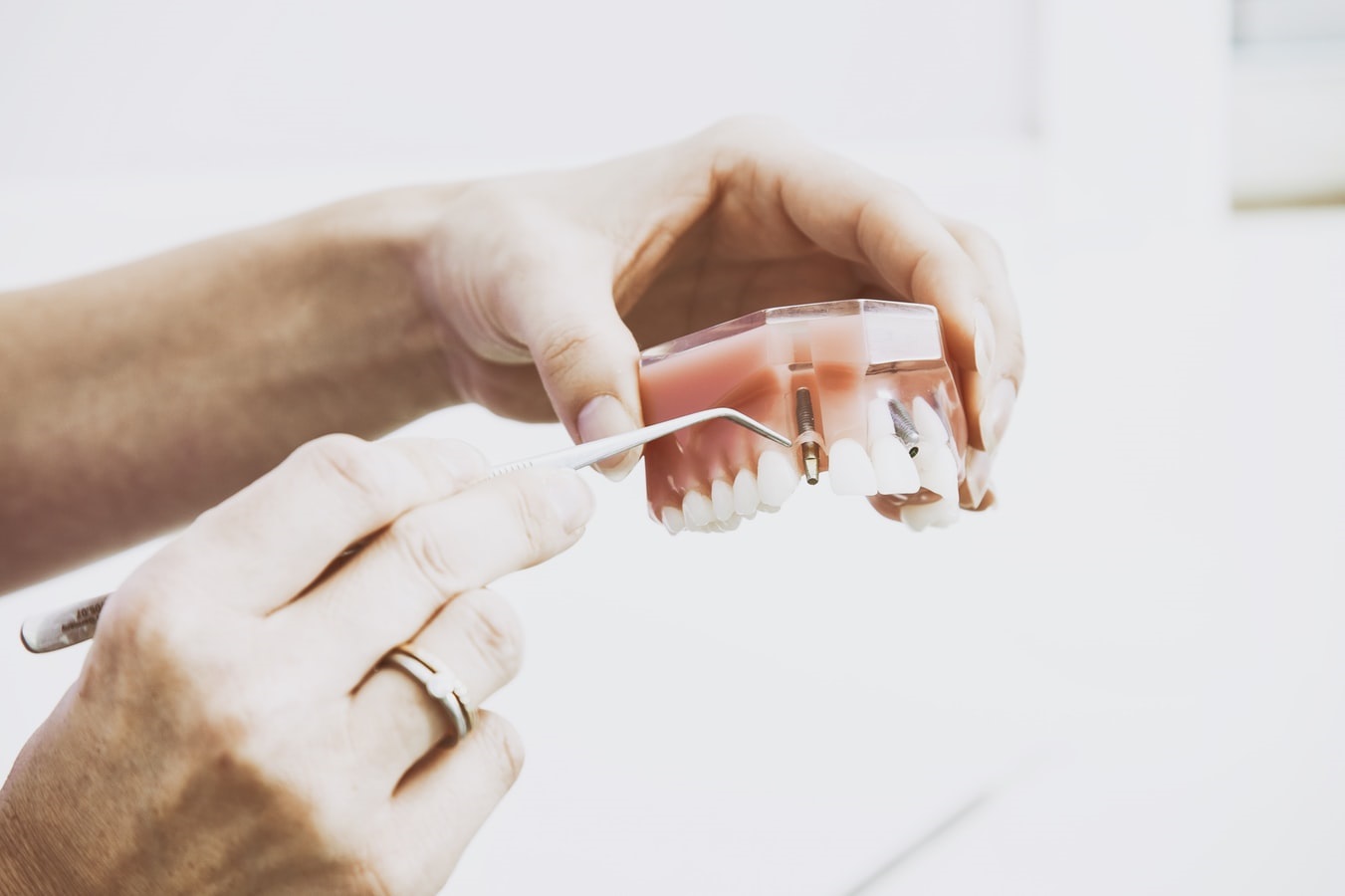 Allgemeine FAQ zur Zahnheilkunde