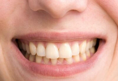 Warum gesunde Zähne so wichtig sind?