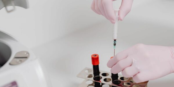 Was ist Renuvion Hautstraffung mittels Plasma?