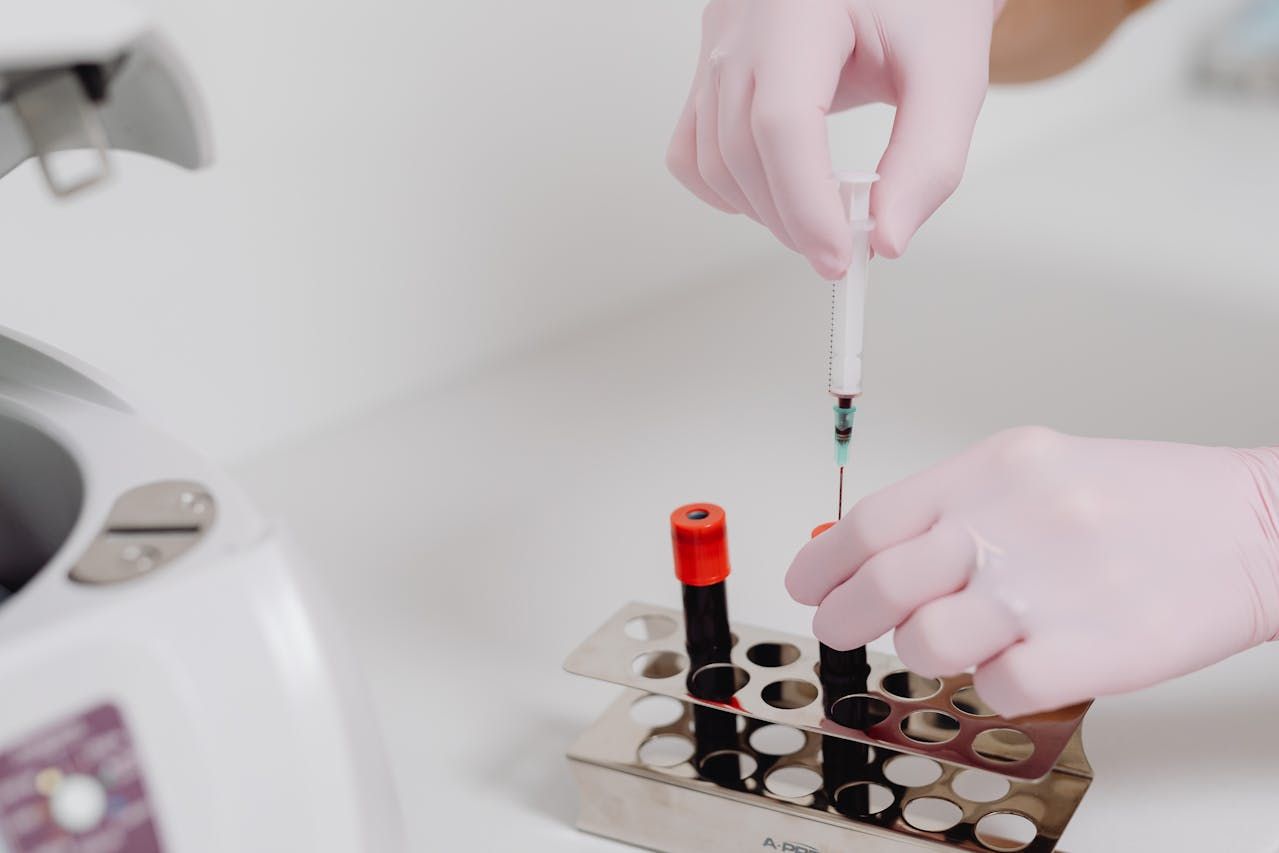 Was ist Renuvion Hautstraffung mittels Plasma?